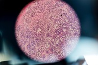 Through-the-microscope view of a tissue sample