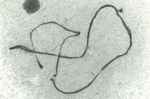Pictured: An X and a Y chromosome from a cell undergoing meiosis, an event that leads to the formation of sperm or egg cells, imaged by electron microscopy. One end of each chromosome is joined at the site where DNA is exchanged between the chromosomes by homologous recombination. Cells also use this process to repair some types of DNA damage.